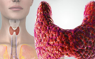 Σημαντικός Αριθμός Επιτυχημένων Ολικών Θυρεοειδεκτομών. Σημαντικός Αριθμός Επιτυχημένων Ολικών Θυρεοειδεκτομών.